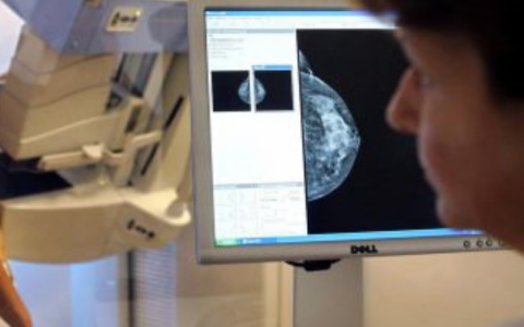 Situazione liste d’attesa Asst Lecco: ortopedia eccellente, mammografie a 468 giorni