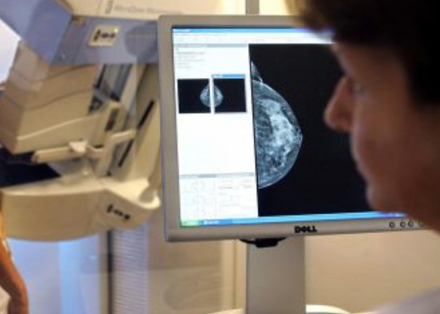 Situazione liste d’attesa Asst Lecco: ortopedia eccellente, mammografie a 468 giorni